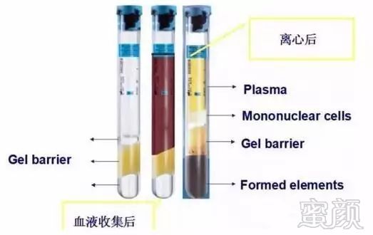 案例图片