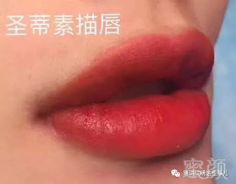 案例图片