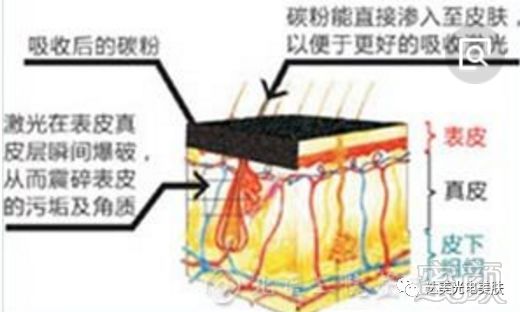 案例图片