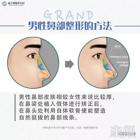 https://img.miyanlife.com/mnt/timg/180206/114334F60-1.jpg