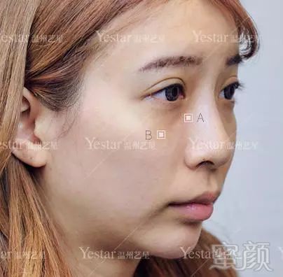 https://img.miyanlife.com/mnt/timg/180206/1153562539-8.jpg