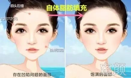 https://img.miyanlife.com/mnt/timg/180206/115J544J-0.jpg