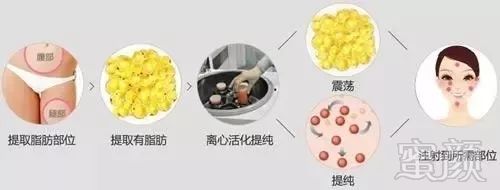 https://img.miyanlife.com/mnt/timg/180206/115J615N-3.jpg