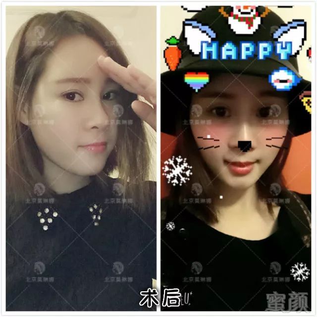 https://img.miyanlife.com/mnt/timg/180206/115JK494-5.jpg