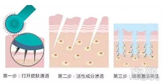 https://img.miyanlife.com/mnt/timg/180206/12110464D-5.jpg