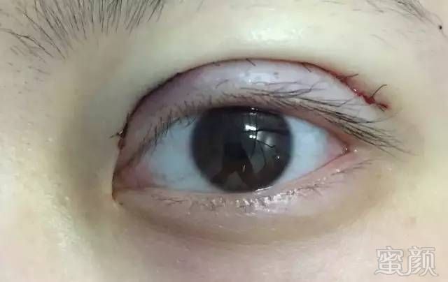 https://img.miyanlife.com/mnt/timg/180206/13553WY2-6.jpg
