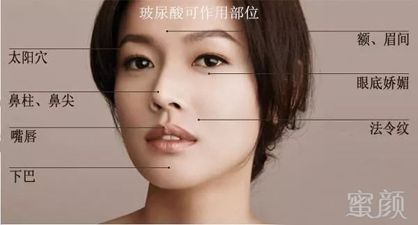 https://img.miyanlife.com/mnt/timg/180207/115FW017-8.jpg