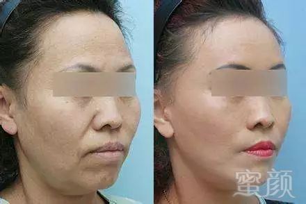 https://img.miyanlife.com/mnt/timg/180207/115FaV6-12.jpg