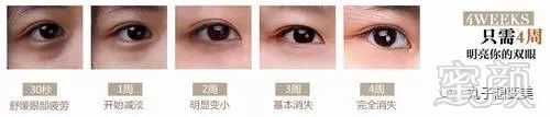 https://img.miyanlife.com/mnt/timg/180207/1209151N2-0.jpg