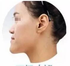 https://img.miyanlife.com/mnt/timg/180207/12095C595-4.jpg