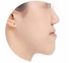 https://img.miyanlife.com/mnt/timg/180207/12095I053-5.jpg