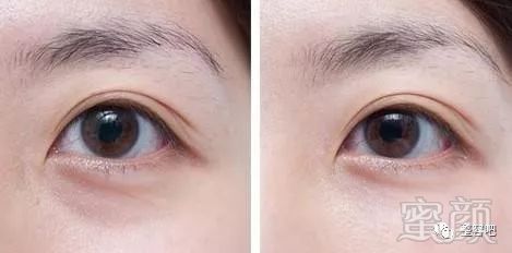 https://img.miyanlife.com/mnt/timg/180207/1210136252-5.jpg