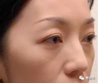 https://img.miyanlife.com/mnt/timg/180207/121013N00-1.jpg
