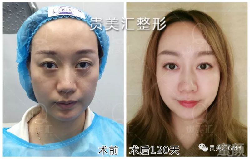 https://img.miyanlife.com/mnt/timg/180207/1211405910-2.jpg
