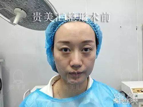 https://img.miyanlife.com/mnt/timg/180207/1211415330-4.jpg