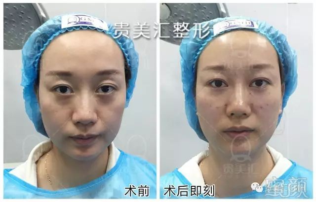 https://img.miyanlife.com/mnt/timg/180207/121141M44-5.jpg