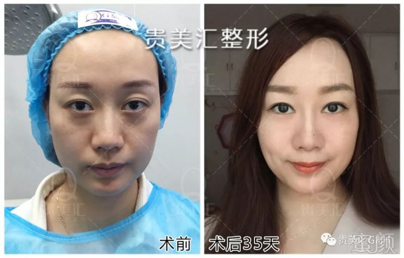 https://img.miyanlife.com/mnt/timg/180207/1211422G6-9.jpg