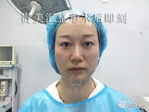 https://img.miyanlife.com/mnt/timg/180207/1211424S1-6.jpg