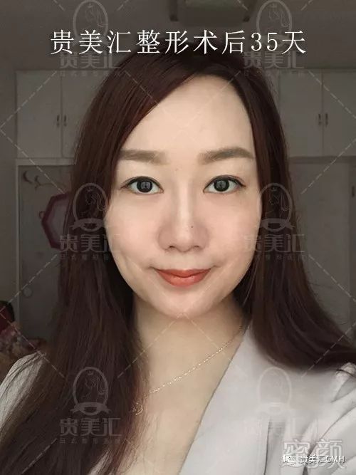https://img.miyanlife.com/mnt/timg/180207/12114332D-10.jpg