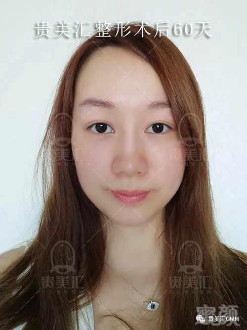 https://img.miyanlife.com/mnt/timg/180207/12114412A-15.jpg