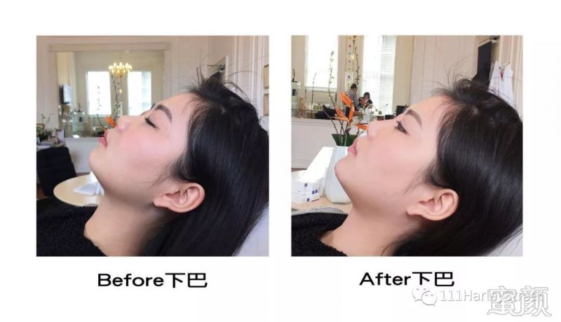 https://img.miyanlife.com/mnt/timg/180207/122H124U-2.jpg