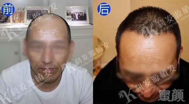 https://img.miyanlife.com/mnt/timg/180207/123H350W-0.jpg