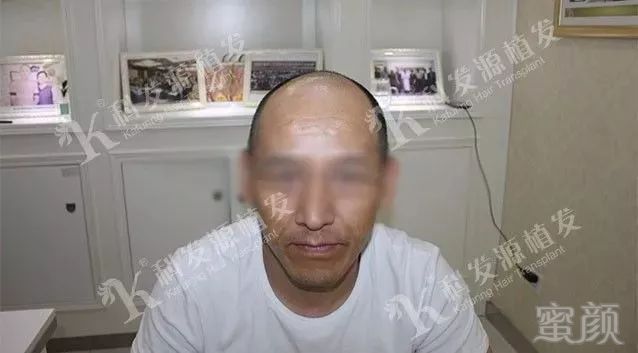 https://img.miyanlife.com/mnt/timg/180207/123H4DE-2.jpg