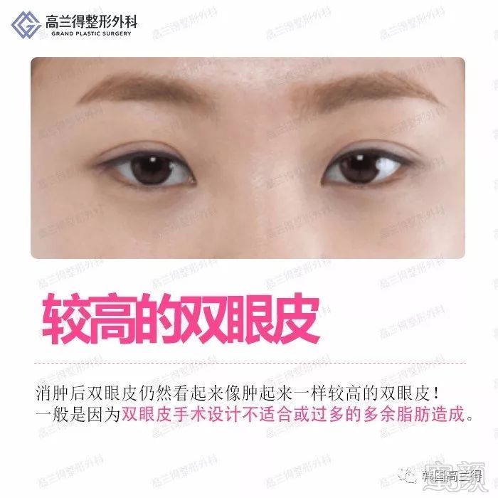 https://img.miyanlife.com/mnt/timg/180207/124531F33-1.jpg