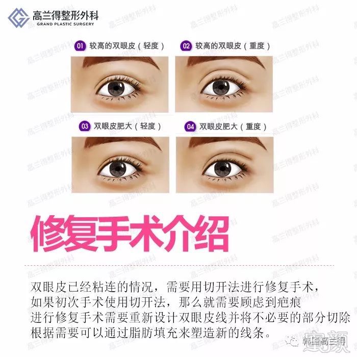https://img.miyanlife.com/mnt/timg/180207/1245322428-2.jpg
