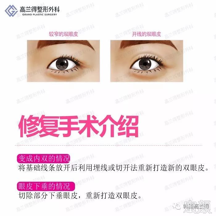 https://img.miyanlife.com/mnt/timg/180207/1245331426-4.jpg