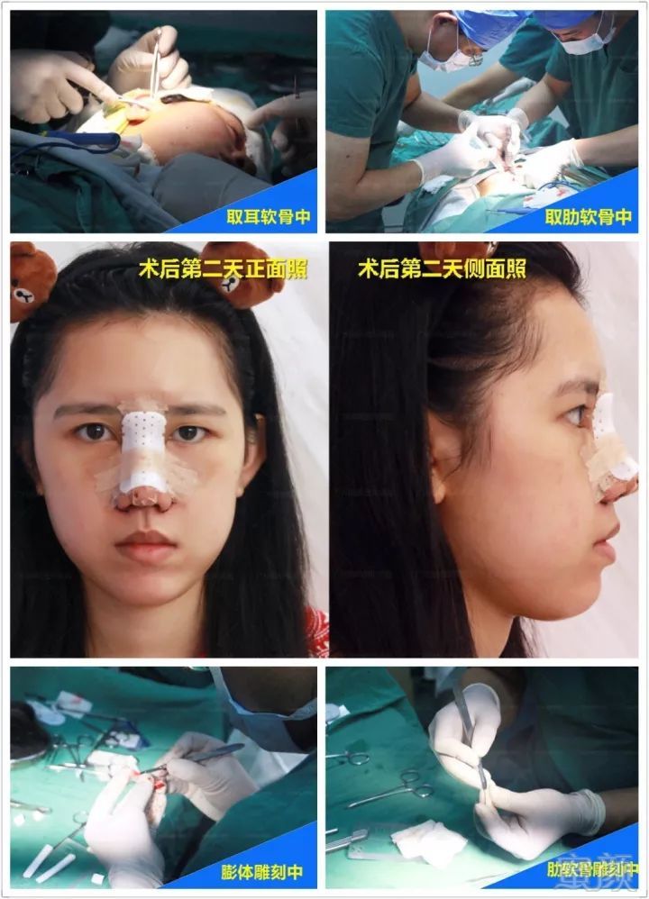 https://img.miyanlife.com/mnt/timg/180207/1254321a9-5.jpg