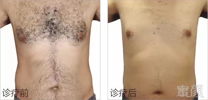 https://img.miyanlife.com/mnt/timg/180208/12340LG7-7.jpg
