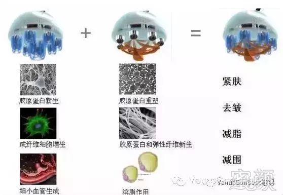 https://img.miyanlife.com/mnt/timg/180208/12340M117-5.jpg