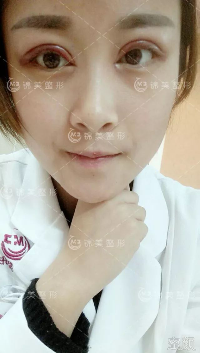https://img.miyanlife.com/mnt/timg/180208/13233IW7-4.jpg