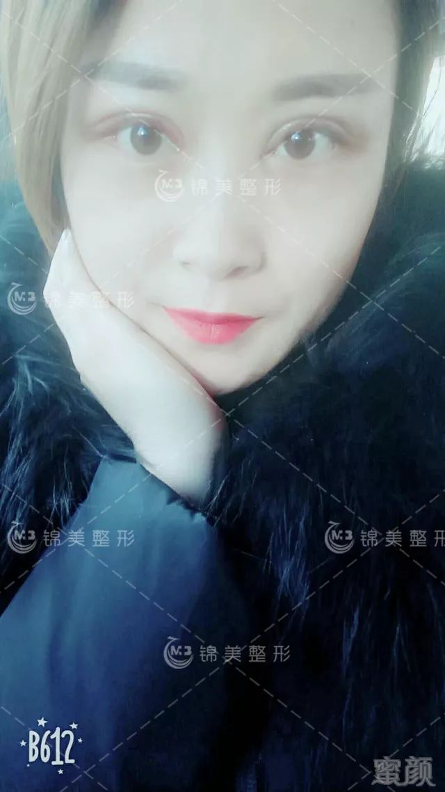 https://img.miyanlife.com/mnt/timg/180208/13233JQ7-5.jpg