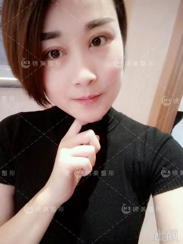 https://img.miyanlife.com/mnt/timg/180208/1323405D3-9.jpg