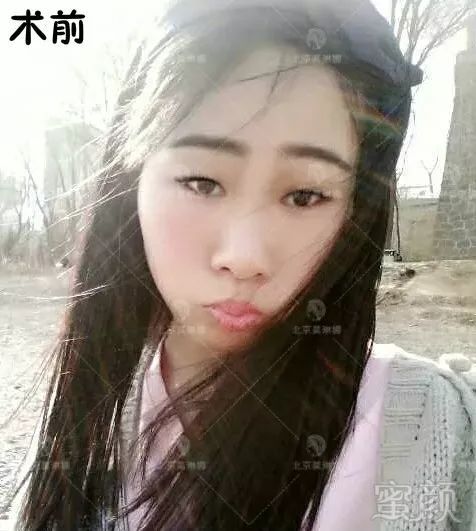 https://img.miyanlife.com/mnt/timg/180208/1323424351-8.jpg