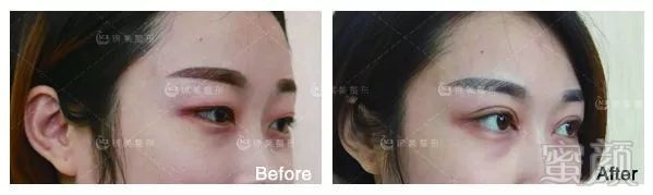 https://img.miyanlife.com/mnt/timg/180208/13234250Y-13.jpg