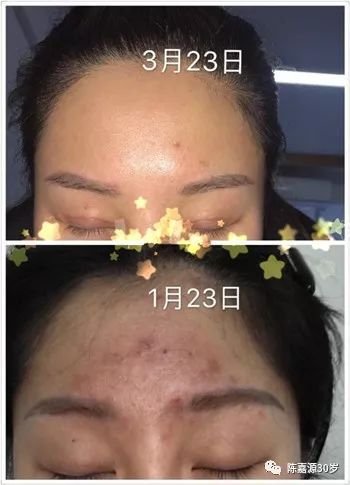 https://img.miyanlife.com/mnt/timg/180208/132H61A6-2.jpg