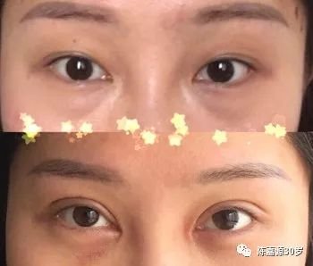 https://img.miyanlife.com/mnt/timg/180208/132HAE0-0.jpg