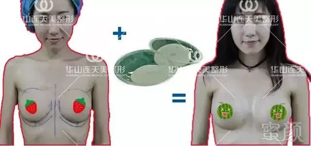 https://img.miyanlife.com/mnt/timg/180208/132I04358-3.jpg
