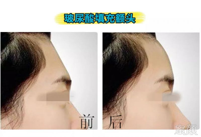 https://img.miyanlife.com/mnt/timg/180208/1401511005-4.jpg