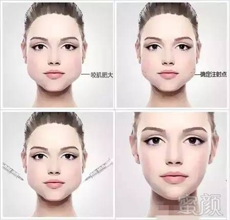 https://img.miyanlife.com/mnt/timg/180209/12360619A-4.jpg