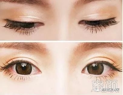 https://img.miyanlife.com/mnt/timg/180209/1240092N0-5.jpg
