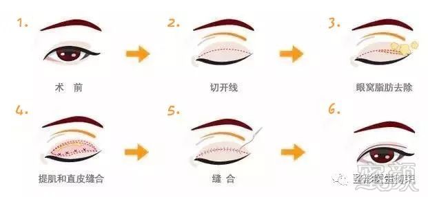 https://img.miyanlife.com/mnt/timg/180209/12400TD8-0.jpg