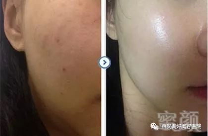 https://img.miyanlife.com/mnt/timg/180209/124J43K9-6.jpg