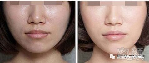 https://img.miyanlife.com/mnt/timg/180209/124J4O61-5.jpg