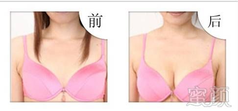 https://img.miyanlife.com/mnt/timg/180209/124JQ955-11.jpg