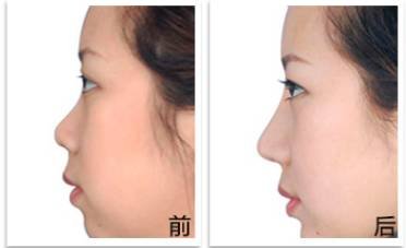 https://img.miyanlife.com/mnt/timg/180209/124JU318-10.jpg