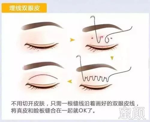 https://img.miyanlife.com/mnt/timg/180209/1300541B7-0.jpg